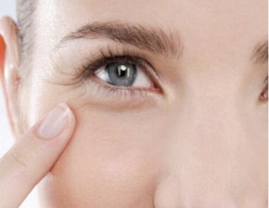 女人眼角纹是怎么形成的 如何去除眼角纹