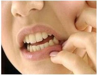 拔牙後要吃消炎藥嗎 拔牙後什麼情況要吃消炎藥