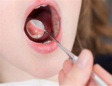 口腔潰瘍是怎麼引起 口腔潰瘍吃什麼水果好