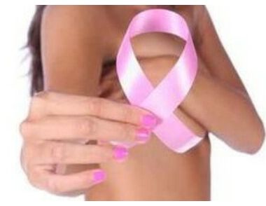 女性乳腺癌症狀有哪些 引起女性乳腺癌的原因