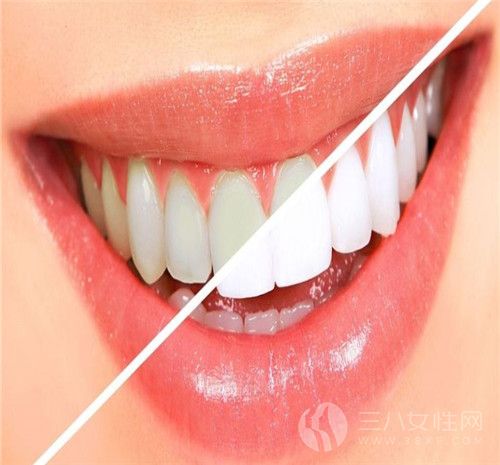 牙齿美白的方法有哪些 这些美白小窍门你要知道4.jpg