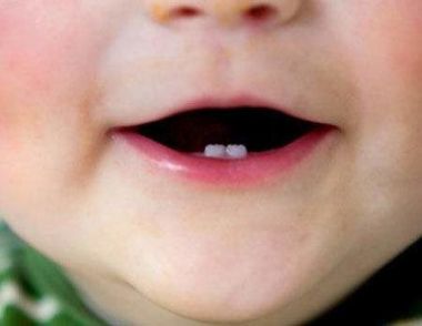 寶寶長牙慢是什麼原因 這五種因素可能導致寶寶長牙慢