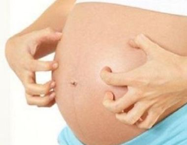 孕婦過敏是什麼原因 孕婦過敏怎麼辦