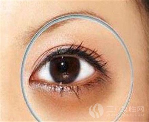 黑眼圈是什么 黑眼圈是如何产生的1.jpg