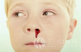 小孩流鼻血是什么原因.jpg