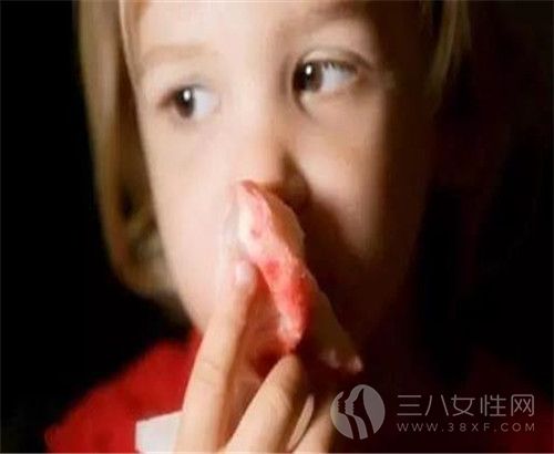 小孩流鼻血是为什么 小孩流鼻血怎么办1.jpg