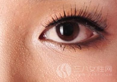 不适当的护肤品造成眼角脂肪粒