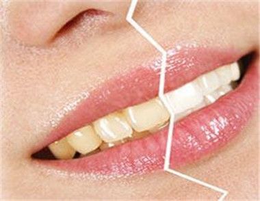 牙齒黃怎麼辦 牙齒黃是哪些原因造成的