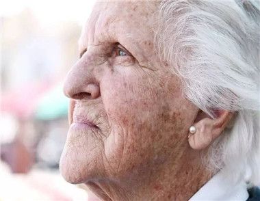 老年斑是怎么形成的 怎样预防老年斑