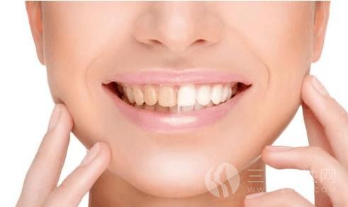 如何预防牙齿变黄 喝矿泉水可以预防牙齿变黄.jpg