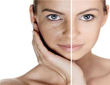 女性肌膚衰老的表現是什麼 出現這4種情況你就要注意了
