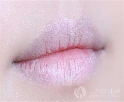 女性嘴唇发白是什么原因 女性嘴唇发白吃什么好1.jpg