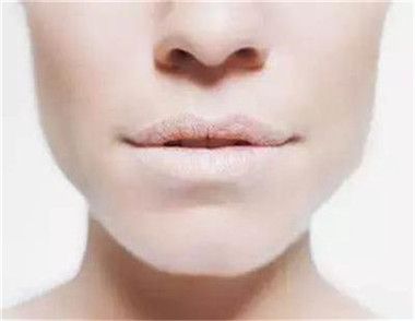 女性嘴唇发白是什么原因 女性嘴唇发白吃什么好
