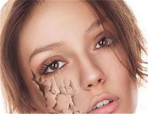 怎么预防皮肤干燥 以下五种方法你知道吗