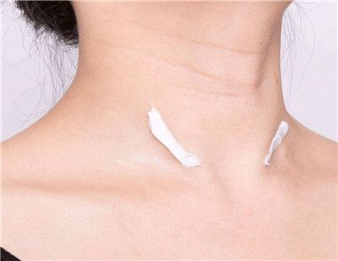 年轻女生长颈纹的原因是什么 如何预防颈纹的产生