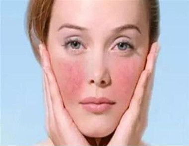 敏感肌膚保養重點 敏感肌膚保養要注意什麼