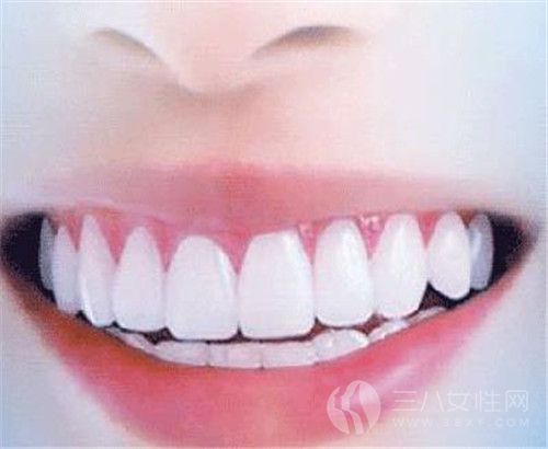 牙龈炎是怎么引起的 牙龈炎的症状有哪些2.jpg
