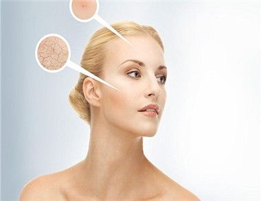 皮肤干燥的原因是什么 年龄是一大因素