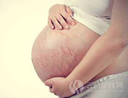 橄榄油去妊娠纹用法
