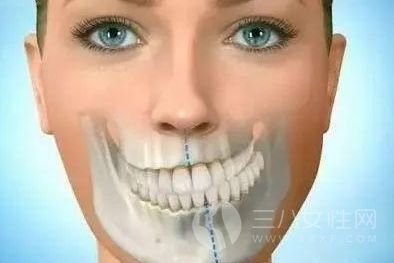 牙形导致脸型不对称