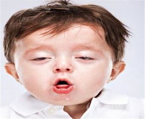 孩子干咳是怎么回事 主要原因就是它2.jpg