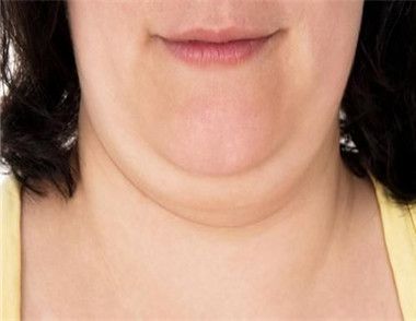 伸舌頭可防止形成雙下巴嗎 預防雙下巴出現方法