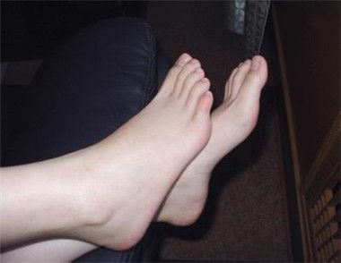 女人脚底脱皮是什么原因 多为脚气所致