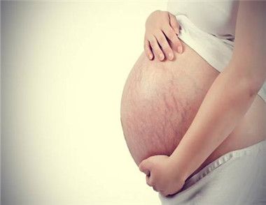 孕妇长妊娠纹的原因是什么 如何预防