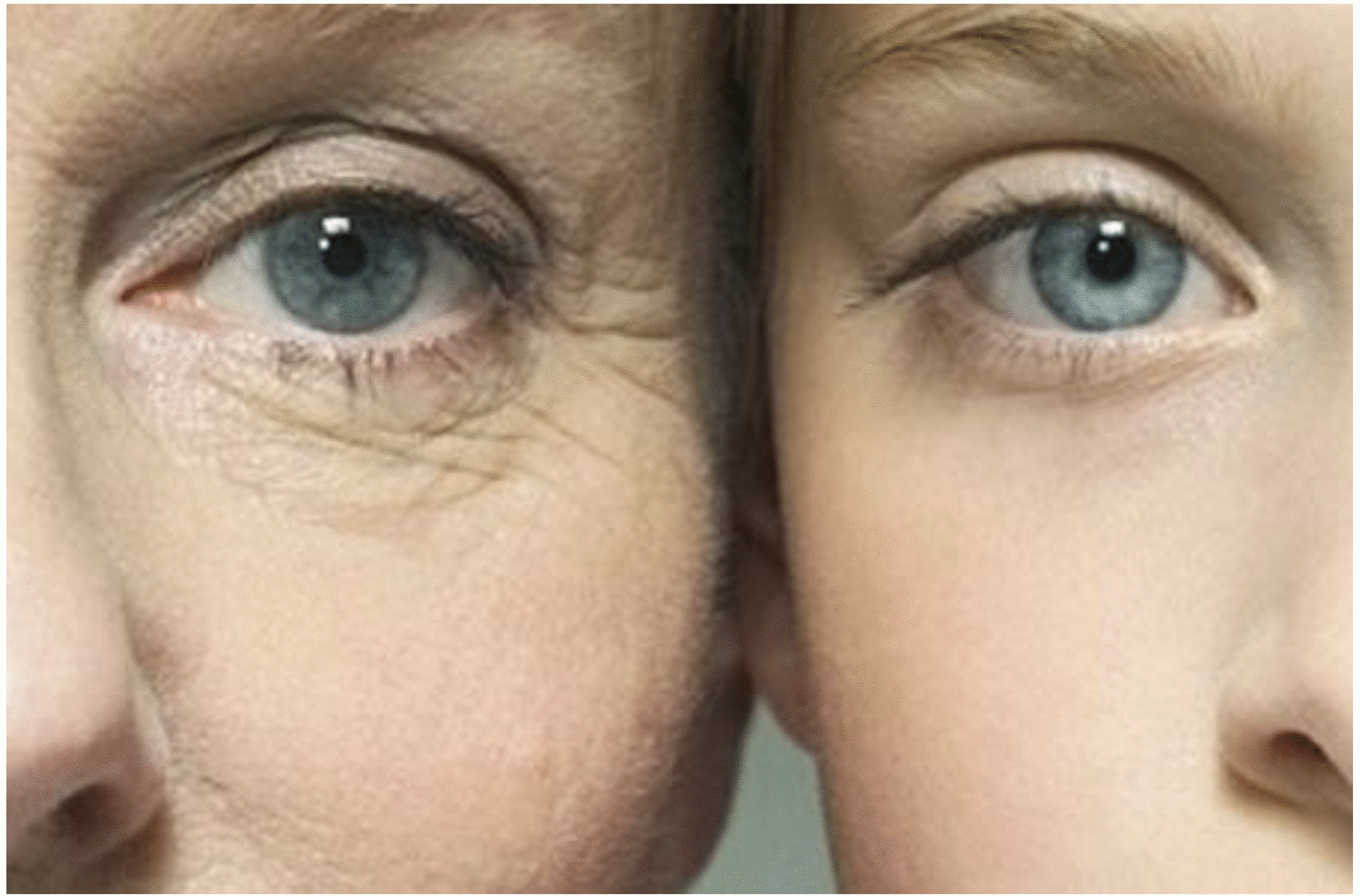眼角皺紋多少歲會長 這些方法簡單有效哦