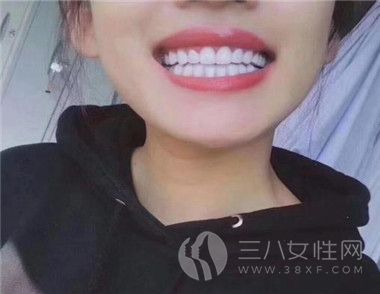 如何預防牙齒黃 美白牙膏有用嗎2.jpg