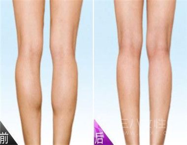 腿粗的人穿什麼褲子顯瘦 怎樣可以瘦腿2.jpg