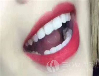 如何预防牙齿黄 美白牙膏有用吗.jpg