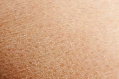 冬季肌肤起皮是怎么回事 怎么处理呢