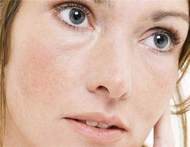 什么护肤品可以去斑?如何减少面部肌肤斑点