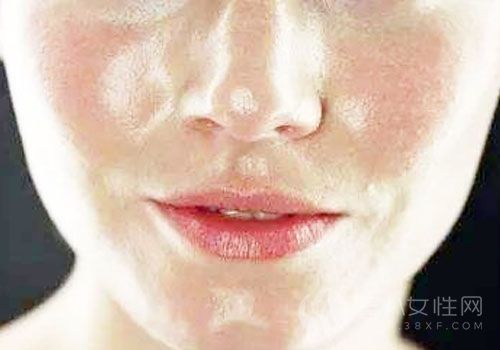 夏季油性皮肤护理方法