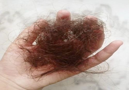 头发属于什么垃圾 怎么预防掉头发
