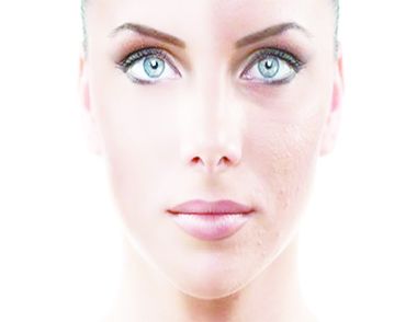 美白祛斑護膚品哪個好 臉上長斑的注意事項
