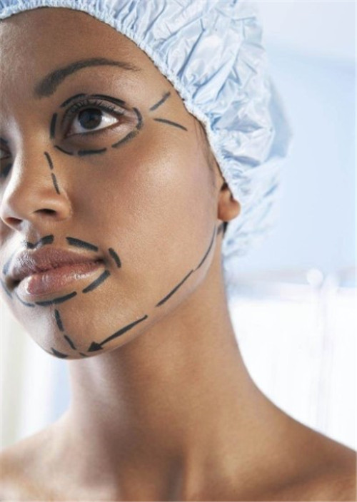 隆鼻手术多久恢复自然 隆鼻手术后多久可以化妆