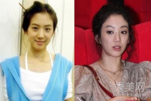 13位韩国女星整容失败 蔡琳变残被求婚