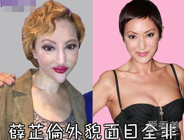 香港名媛薛芷伦反驳整容说 容貌变丑是抗癌导致