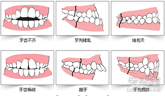 13位明星整牙前後 為啥隻有Baby楊冪變美？