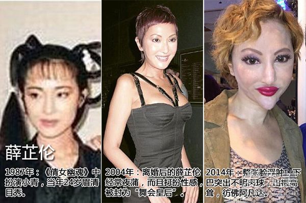 香港名媛薛芷伦反驳整容说 容貌变丑是抗癌导致