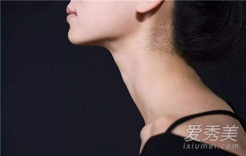 颈纹能用激光消除吗 颈纹是怎么形成的
