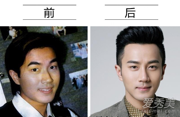 黄晓明陈伟霆也整容？ 男星今昔对比揭秘真相