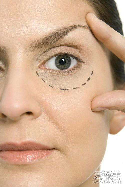 眼部脂肪粒是怎么形成的 眼部脂肪粒的原因