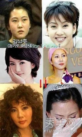 13位韩国女星整容失败 蔡琳变残被求婚