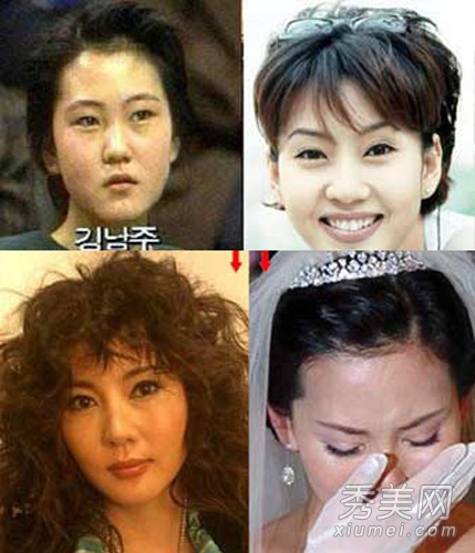 蔡琳全智贤 第一代韩女星整容后遗症浮现