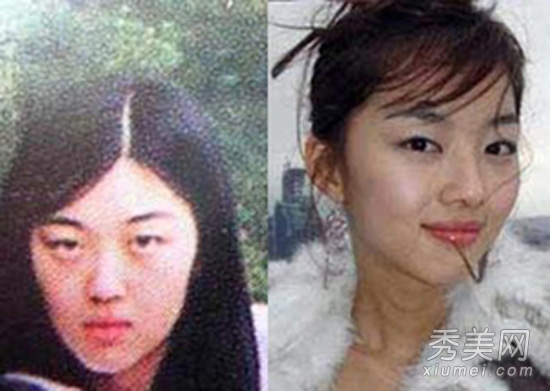 少女时代尹恩惠 26位韩明星整容对比照（二）