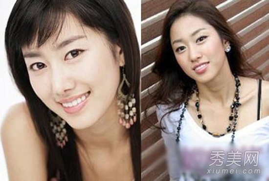 少女时代尹恩惠 26位韩明星整容对比照（一）