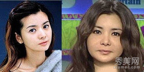 少女时代尹恩惠 26位韩明星整容对比照（一）